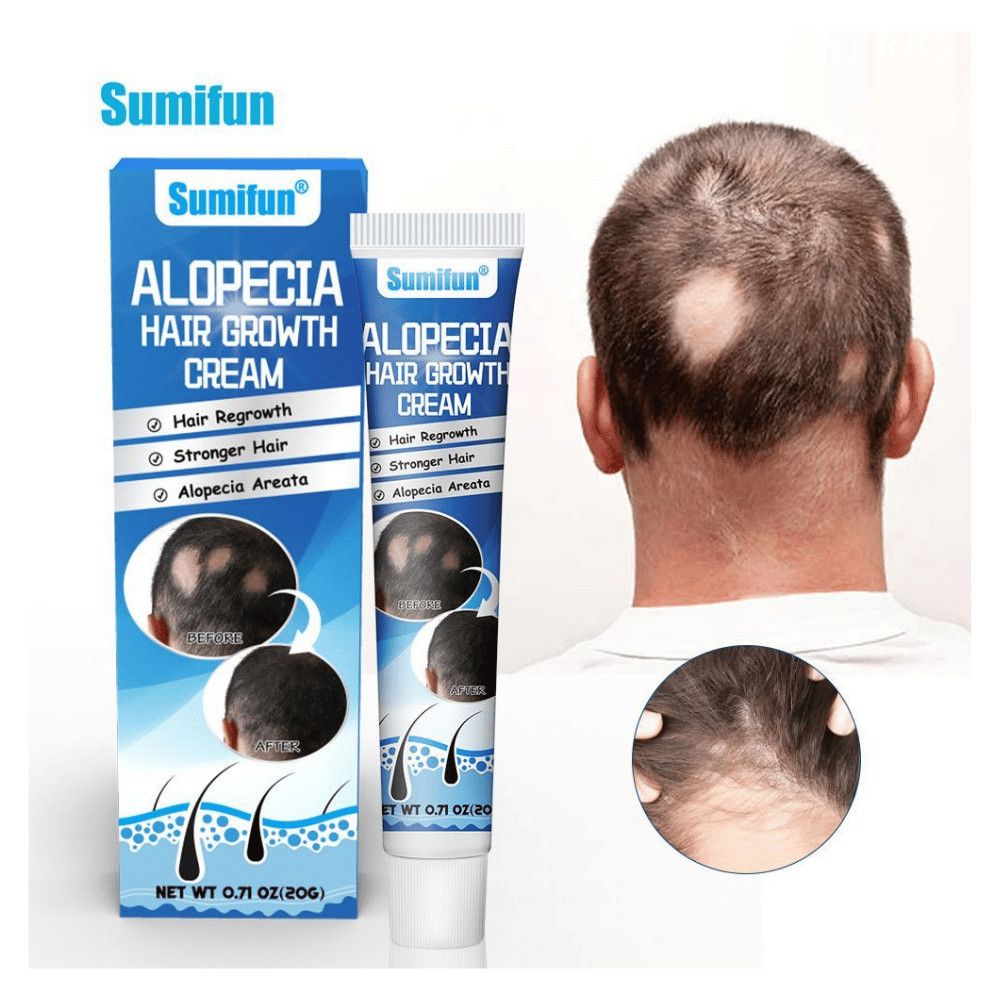 Sumifun Hair Growth Cream – Anti Hair Loss & Regrowth Cream for Men & Women