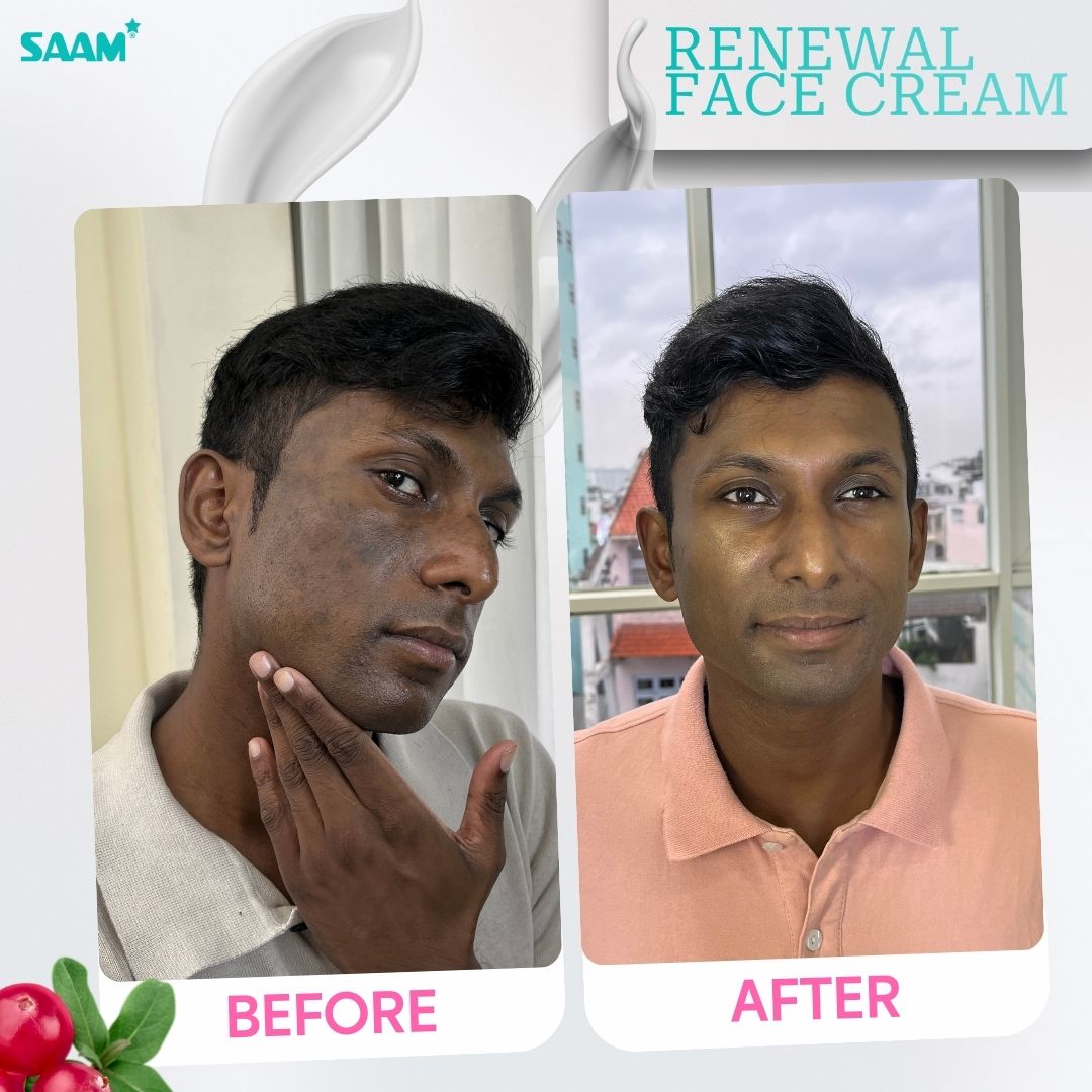 SAAM Renewal Face Cream Original | Daily Moisturizing & Skin Repair Cream